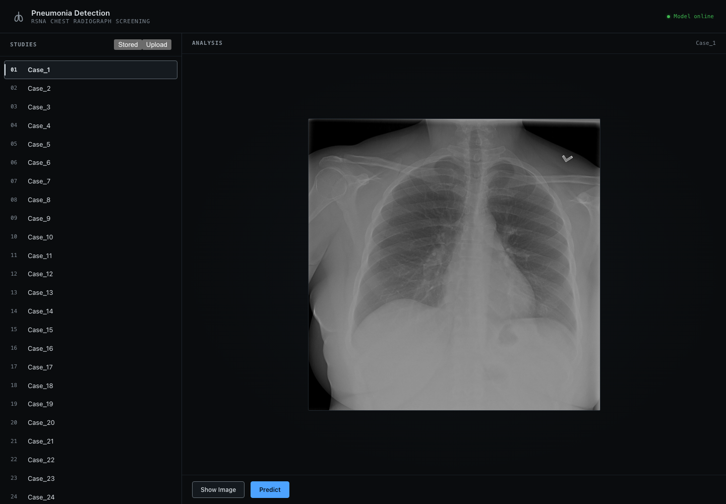 RSNA application displaying the real radiograph for stored study Case_1